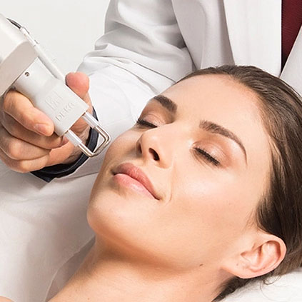 tratamientos láser en Lima