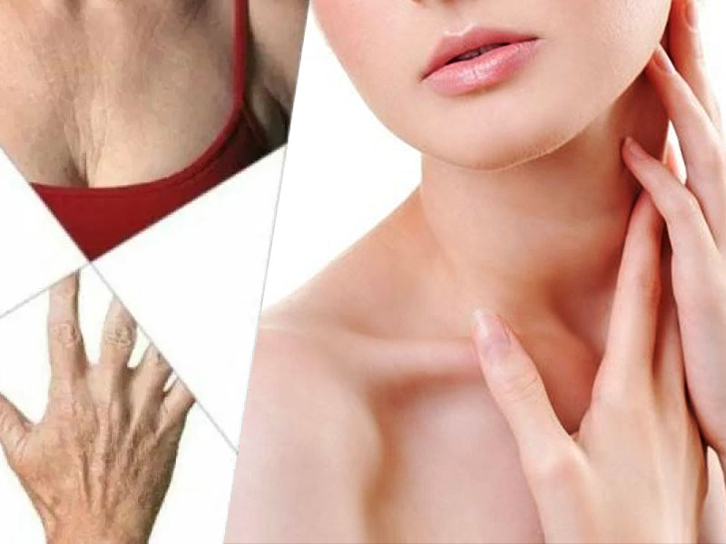 Rejuvenecimiento de cuello, escote y manos