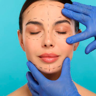 Armonización-Facial
